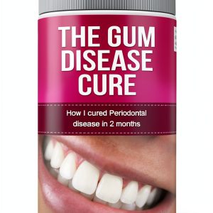 Kindle Periodontics Guide by Amazon-0